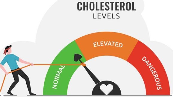 Cholesterol: కొలెస్ట్రాల్  కంట్రోల్‌లో ఉండాలంటే.. ఈ 3 పనులు చేయండి
