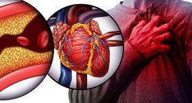 Heart Attack: ఉన్నపాటుగా ప్రాణాలను తోడేస్తున్న గుండెపోటు, వీటిని అస్సలు లైట్ తీసుకోవద్దు !