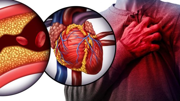Heart Attack: ఉన్నపాటుగా ప్రాణాలను తోడేస్తున్న గుండెపోటు, వీటిని అస్సలు లైట్ తీసుకోవద్దు !
