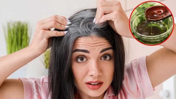 Oil For White Hair: తెల్ల జుట్టును నల్లగా మార్చడంలో.. వీటి తర్వాతే, ఏదైనా !