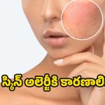 Skin Allergy: స్కిన్ అలెర్జీకి కారణాలేంటో తెలుసా ?