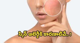 Skin Allergy: స్కిన్ అలెర్జీకి కారణాలేంటో తెలుసా ?