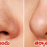 Blackheads On Nose: ముక్కుపై నల్ల మచ్చలా ? ఇవి వాడితే.. ప్రాబ్లమ్ సాల్వ్ !