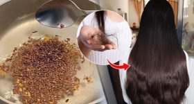 Hair Growth Serum: ఈ హెయిర్ సీరం వాడితే.. జుట్టు వద్దన్నా పెరుగుతుంది