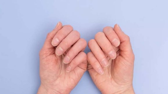 Nails: గోళ్లను చూసి మీకున్న ఆరోగ్య సమస్యలు తెలుసుకోవచ్చు.. ఎలాగంటే ?