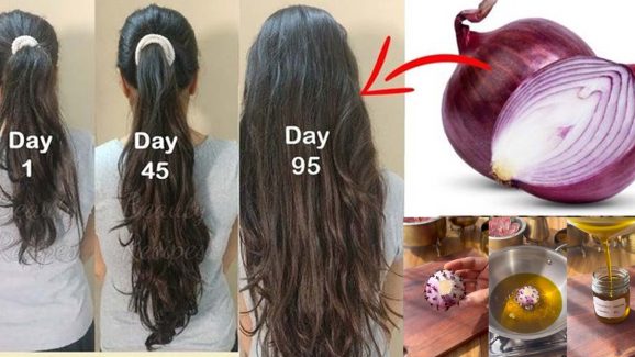 Onion And Cloves For Hair: ఈ ఆయిల్ ఒక్క సారి వాడినా చాలు.. జుట్టు రాలడం పూర్తిగా ఆగిపోతుంది !