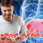 Fatty Liver: ఐటీ ఉద్యోగుల్లో ఫ్యాటీ లివర్ సమస్య.. పరిశోధనల్లో షాకింగ్ నిజాలు !