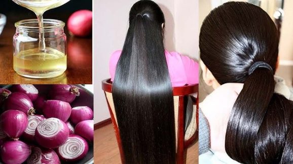 Homemade Oil: ఉల్లిపాయ రసంలో ఈ  2 కలిపి రాస్తే.. జుట్టు వద్దన్నా పెరుగుతుంది !