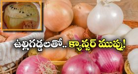 Black Molds On Onions:  ఉల్లి గడ్డలను ఇలా అస్సలు తినకండి, లేదంటే క్యాన్సర్ రావడం పక్కా!
