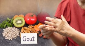 Uric Acid Diet: శరీరంలో యూరిక్ యాసిడ్ సమస్య తగ్గాలంటే.. ఈ ఫుడ్ తినండి చాలు !