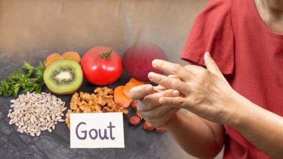 Uric Acid Diet: శరీరంలో యూరిక్ యాసిడ్ సమస్య తగ్గాలంటే.. ఈ ఫుడ్ తినండి చాలు !
