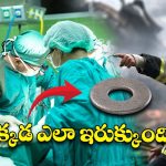 Iron Washer in Private Part : వ్యక్తి ప్రైవేట్ పార్ట్‌లో ఇరుక్కున్న ఐరన్ వాషర్.. డాక్టర్లు చేయలేనిది ఫైర్ ఫైటర్స్ చేశారు!