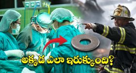 Iron Washer in Private Part : వ్యక్తి ప్రైవేట్ పార్ట్‌లో ఇరుక్కున్న ఐరన్ వాషర్.. డాక్టర్లు చేయలేనిది ఫైర్ ఫైటర్స్ చేశారు!