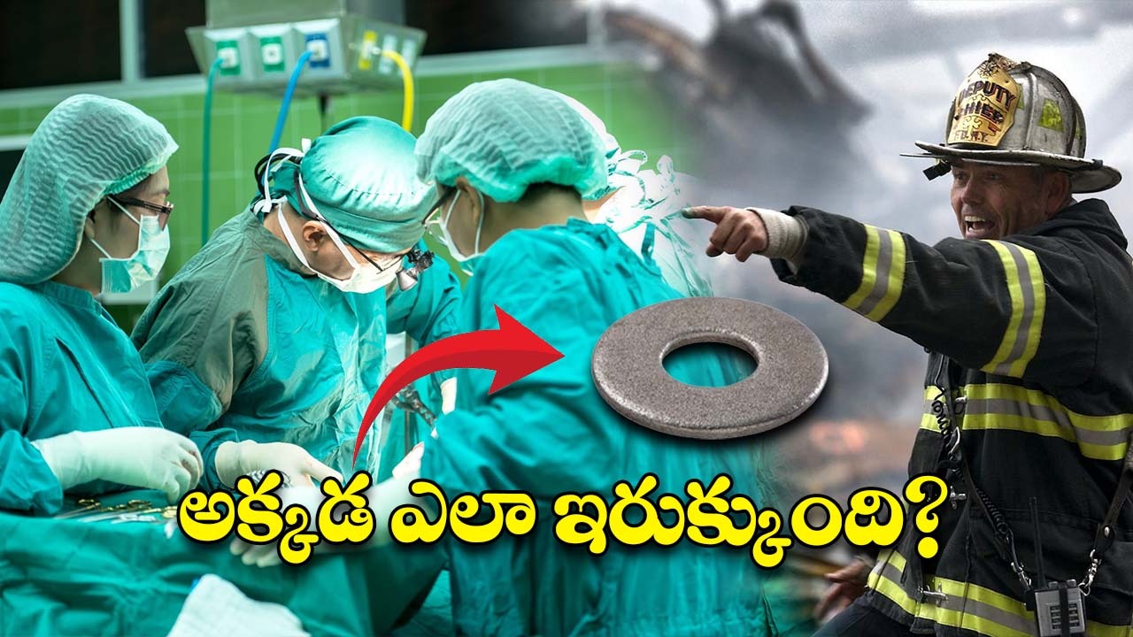 Iron Washer in Private Part : వ్యక్తి ప్రైవేట్ పార్ట్‌లో ఇరుక్కున్న ఐరన్ వాషర్.. డాక్టర్లు చేయలేనిది ఫైర్ ఫైటర్స్ చేశారు!