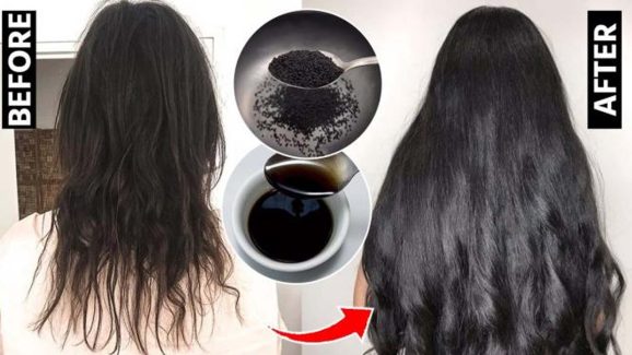 Oil For Healthy Hair: జుట్టు పలచబడిందా ? అయితే ఈ హెయిర్ ఆయిల్ ట్రై చేయండి