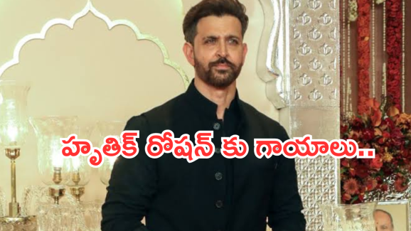War2 Movie: ‘వార్ 2’ మూవీ డ్యాన్స్ ప్రాక్టీస్ లో హృతిక్ రోషన్ కి తీవ్ర గాయాలు..