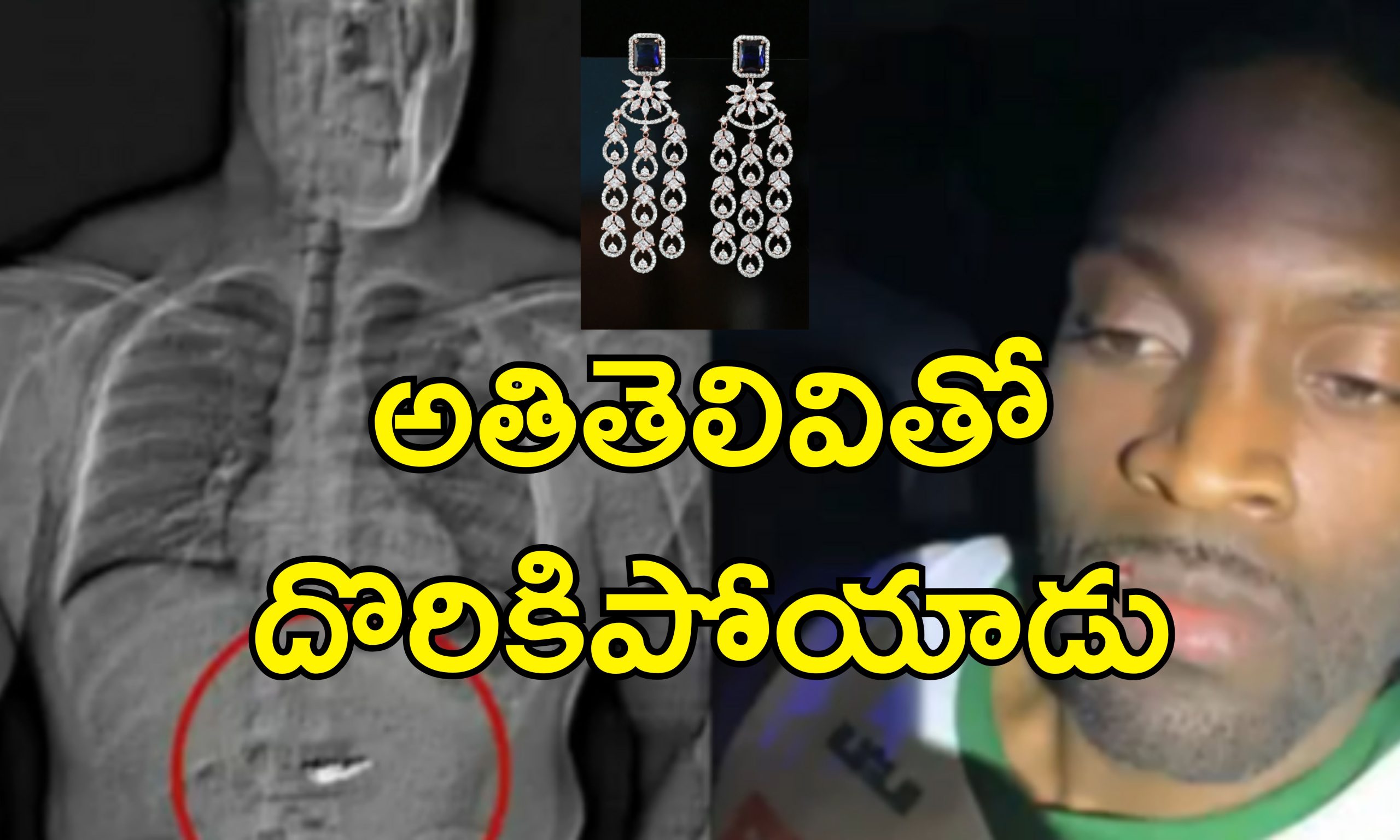 Thief swallows diamond : అరెస్టు భయంతో కోట్లు విలువైన వజ్రాలను మింగేసిన దొంగ.. పోలీసులు ఎలా తెలుసుకున్నారంటే?..