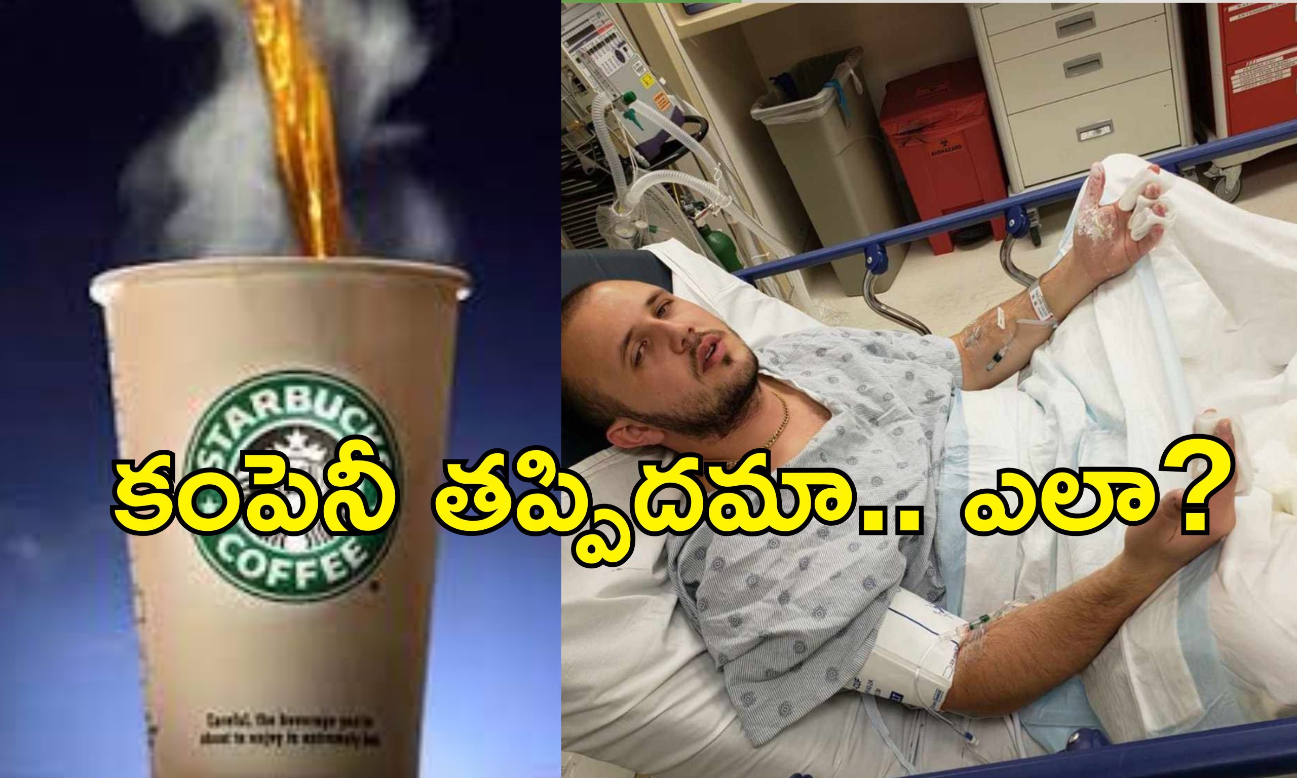 Starbucks HotDrink Burns: వేడి వేడి కాఫీ పడి కస్టమర్‌కు తీవ్ర గాయాలు.. కెఫె కంపెనీకి రూ.415 కోట్లు ఫైన్ విధించిన కోర్టు