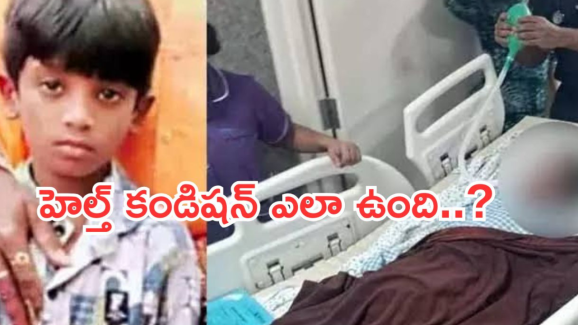 Sri Tej Health Update : శ్రీ తేజ్ లేటెస్ట్ హెల్త్ అప్డేట్… ఇంకా వెంటిలేటర్ పైనే..