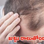 Hair Loss Reasons: రోజు రోజుకు జుట్టు పలచబడుతోందా ? కారణాలివే !