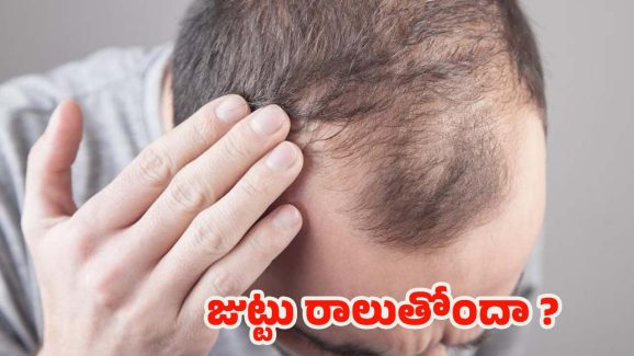 Hair Loss Reasons: రోజు రోజుకు జుట్టు పలచబడుతోందా ? కారణాలివే !