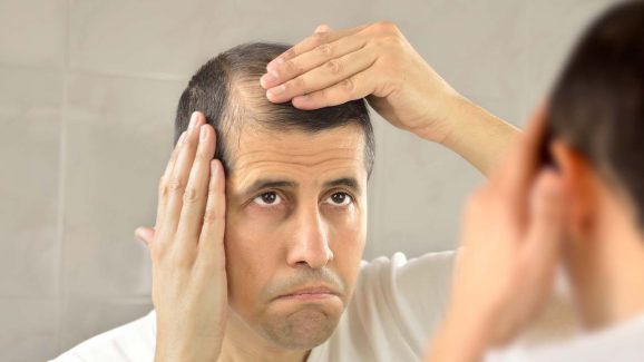 Seasonal Hair Fall: ఇలా చేస్తే.. ఎండాకాలంలో హెయిర్ ఫాల్‌కు చెక్ !