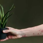 Cure Psoriasis: సోరియాసిస్‌ను సహజంగా తగ్గించుకోవడం సాధ్యమేనా? దీనికి శాశ్వతంగా చెక్ పెట్టడమెలా..?