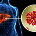 Hepatitis: హెపటైటిస్ రిస్క్ నుంచి కాపాడుకోవడానికి ఇలా చేయండి..
