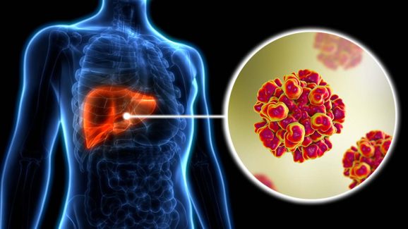 Hepatitis: హెపటైటిస్ రిస్క్ నుంచి కాపాడుకోవడానికి ఇలా చేయండి..