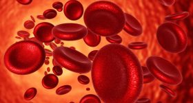 Anemia: ఎనీమియాతో ఇబ్బంది పడుతున్నారా? ఈ ఫుడ్స్‌ని డైట్‌లో యాడ్ చేసి చూడండి..