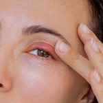Stye: కంటి కురుపు ఎందుకు వస్తుంది? ఇంట్లోనే దీన్ని తగ్గించడం సాధ్యమేనా?