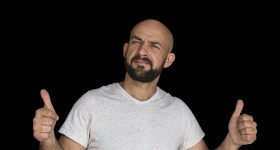 Bald head: అమ్మాయిలకు బట్టతల ఎందుకు రాదు? అబ్బాయిలకే ఎందుకు?
