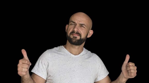 Bald head: అమ్మాయిలకు బట్టతల ఎందుకు రాదు? అబ్బాయిలకే ఎందుకు?