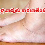 Leg Swelling: కాళ్ల వాపుకు కారణాలు ఏంటి ?  ఎలా తగ్గించుకోవాలో తెలుసా ?
