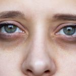 Dark circles: కళ్ల కింద డార్క్ సర్కిల్స్‌ని అలాగే వదిలేయకండి.. ఇలా చేస్తే కళ్లు అందంగా మారతాయి