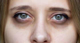 Dark circles: కళ్ల కింద డార్క్ సర్కిల్స్‌ని అలాగే వదిలేయకండి.. ఇలా చేస్తే కళ్లు అందంగా మారతాయి