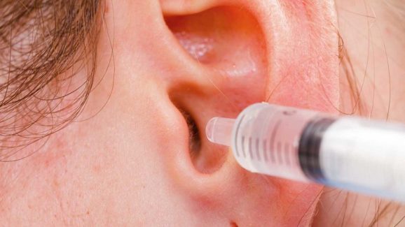 Ear Problems: చెవులు శుభ్రంగా లేకుంటే చెవుడు వస్తుందట..! మరి క్లీన్ చేసుకోవడమెలా?
