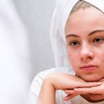 Pimples: ఏం చేసినా మొటిమలు తగ్గట్లేదా..? ఈ సింపుల్ టిప్స్ ట్రై చేసి చూడండి