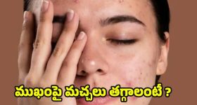 Black Spots: ముఖంపై మచ్చలు తగ్గి, తెల్లగా మెరిసిపోవాలంటే.. ఈ టిప్స్ ట్రై చేయండి