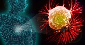Cancer Symptoms: మీలో ఈ లక్షణాలున్నాయా ? క్యాన్సర్ కావొచ్చు జాగ్రత్త  !