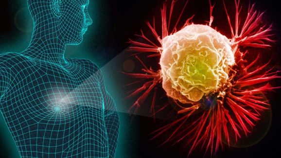 Cancer Symptoms: మీలో ఈ లక్షణాలున్నాయా ? క్యాన్సర్ కావొచ్చు జాగ్రత్త  !
