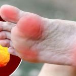 High Cholesterol: కొలెస్ట్రాల్ పెరిగితే.. పాదాల్లో కనిపించే లక్షణాలు ఇవే !