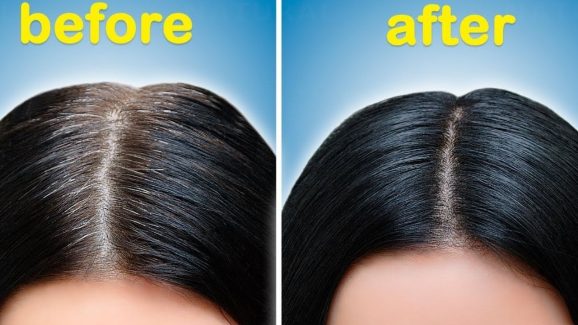 White Hair: ఇలా చేస్తే.. జన్మలో తెల్ల జుట్టు రాదు !
