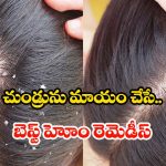 Hair Mask For Dandruff: వీటితో.. క్షణాల్లోనే చుండ్రు మాయం !