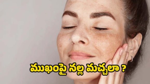 Dark Spots On Face: ముఖంపై నల్ల మచ్చలా ? ఇలా చేస్తే.. సమస్య దూరం