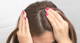 Dandruff: చుండ్రు ఎందుకు వస్తుంది? చిట్కాలతో దీన్ని తగ్గించుకోవచ్చా..?