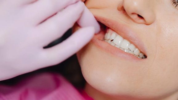 Toothache: పంటి నొప్పి ఎందుకు వస్తుంది? దీన్ని తగ్గించే మార్గం లేదా..?