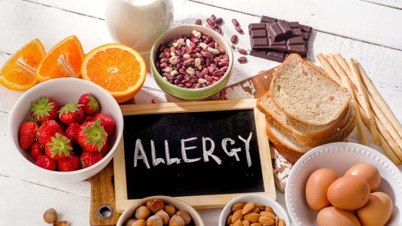 Skin Allergy: స్కిన్ అలెర్జీ ఉన్న వారు.. వీటిని అస్సలు తినకూడదు !