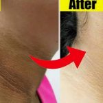 Neck Tanning: ఇలా చేస్తే.. మెడపై ఉన్న నలుపు క్షణాల్లోనే మాయం !