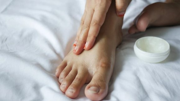 Cracked heels: మడమలు పగిలిపోయాయా..? ఇలా చేస్తే ఇట్టే తగ్గిపోతాయి